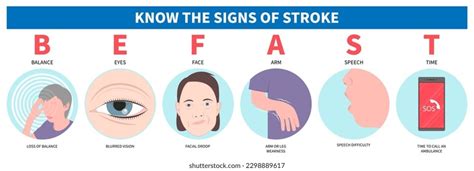 Sign Symptom Paralysis Eye Face Arm Stock Vector (Royalty Free ...