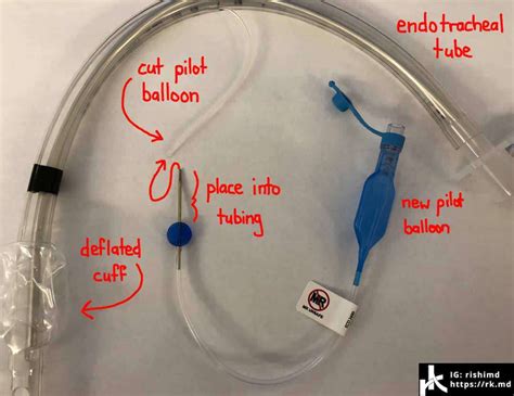 Repairing Endotracheal Tube Cuffs | RK.MD