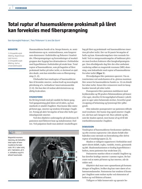 (PDF) Complete proximal hamstring tendon rupture can be misinterpreted ...