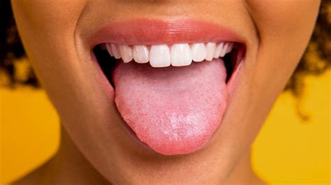 What Does Your Tongue Say About Your Health? | Blogging Heros