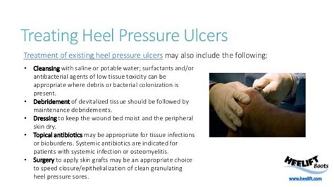 Heel Pressure Ulcer Prevention