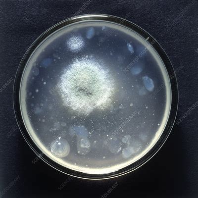 Yeast culture in petri dish - Stock Image - C053/3798 - Science Photo ...