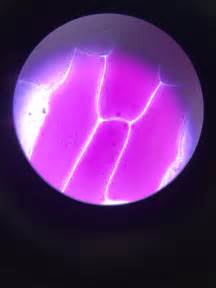 Plasmolysis of onion cells