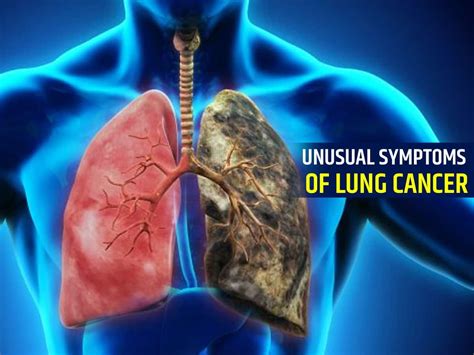 Emphysema Symptoms Lung Cancer Symptoms