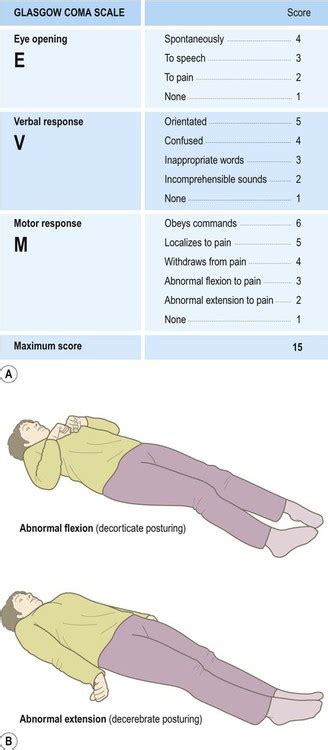 Head injury | Neupsy Key