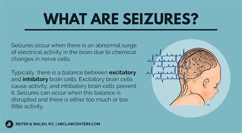 Neonatal (Infant) Seizures | Birth Injury Attorneys | Seizures, Medical knowledge, Nerve cell