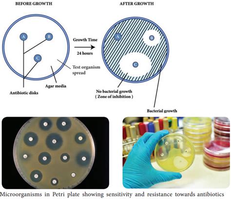 Antimicrobial Susceptibility Testing