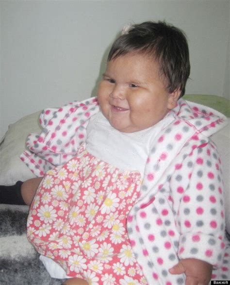 Obese Baby With Mystery Illness Weighs 20Kgs At Just 10 Months Old | HuffPost UK Life