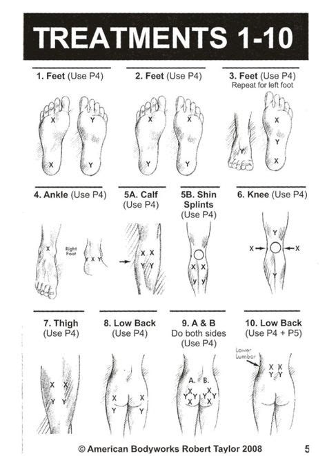 Tens Unit Placement Diagram