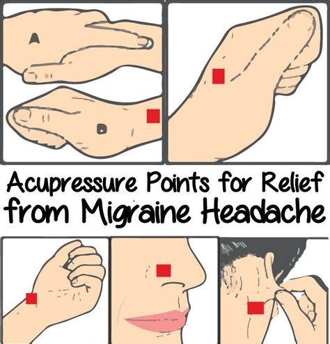 Acupressure Points for Relief from Migraine Headache | Natural headache ...