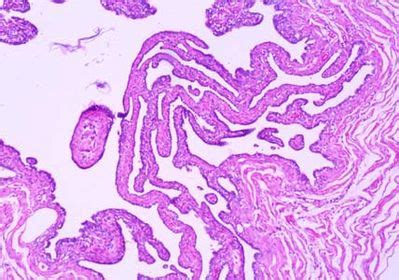 Oviduct Histology - Oviduct - histology slide