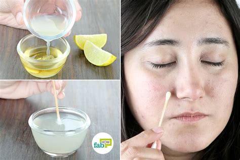 13 Ways to Remove Dark Spots with Lemon Juice | Fab How