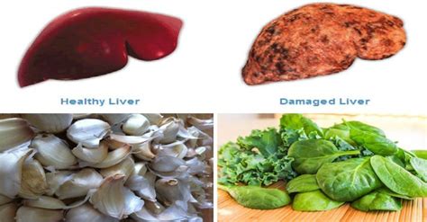 Reverse Liver Damage, Clear Toxins and Improve Digestion with These Natural Solutions (8 Liver ...