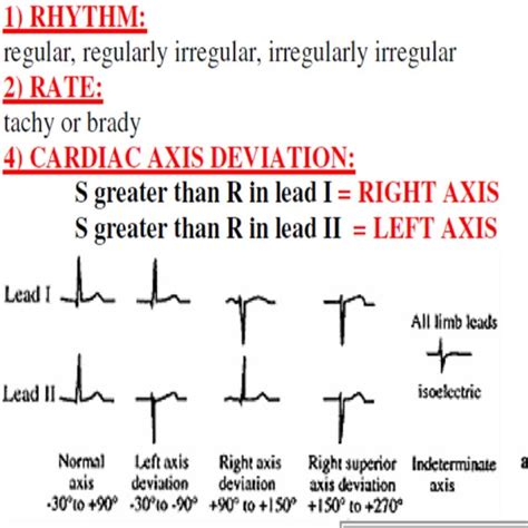 Any nurse must know ECG Interpretation Cheat Sheet made easy | Etsy