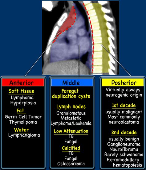 Mediastinal Tumors | Medical ultrasound, Pediatrics, Radiology imaging