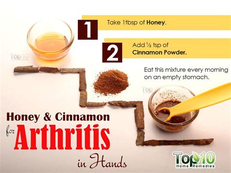 Home Remedies for Arthritis in Hands | Top 10 Home Remedies