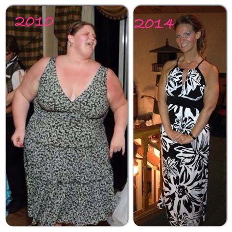 Michelle's before and after Lap Band surgery photos. | Lap band surgery ...