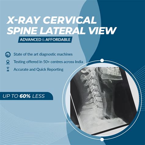 Cervical Spine Lateral View X-ray - Aarthi Scans and Labs