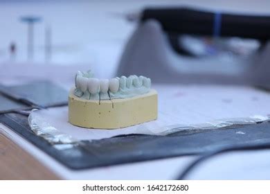 971 Artificial Dentition Images, Stock Photos & Vectors | Shutterstock