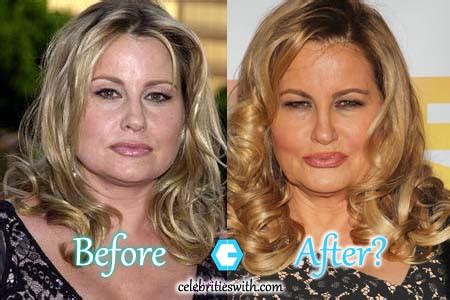 Jennifer Coolidge Plastic Surgery: Before After Facelift Pictures | CelebritiesWith