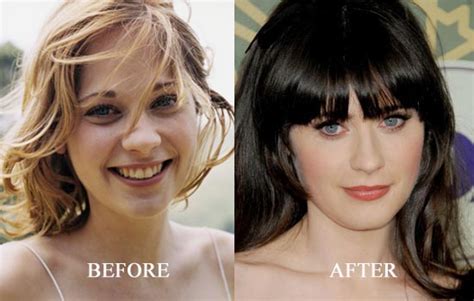 Zooey Deschanel Plastic Surgery Before And After Nose Job Photos