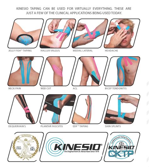 Kinesio Taping can be used for virtually everything, these are just a few of the clinical ...