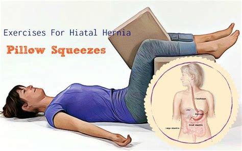 16 Safe Exercises For Hiatal Hernia To Follow | Hernia exercises, Safe exercises, Easy yoga workouts