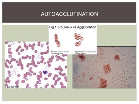 Blood smear evaluation