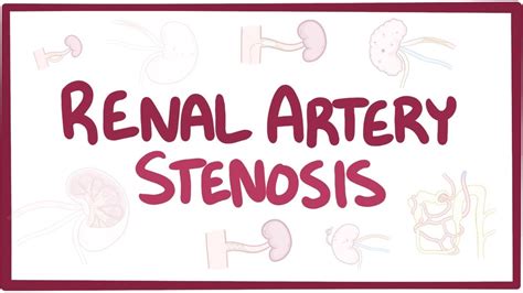 Renal artery stenosis - causes, symptoms, diagnosis, treatment, pathology - YouTube