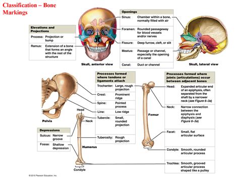 Classification of Bone Markings Diagram - PLN 103 - Classification – Bone Markings - Studocu