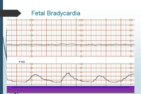 Assessment of Fetal Well Being Heather M Said