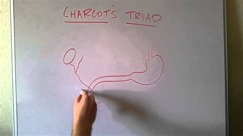 Charcot's Triad for Ascending Cholangitis - YouTube