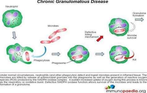 chronic-granulomatous-disease | Immunopaedia