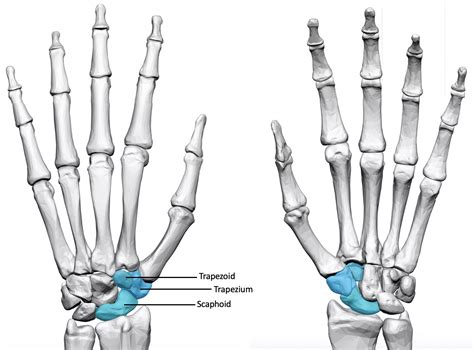 Tri-scaphoid Osteoarthritis – Aberdeen Virtual Hand Clinic