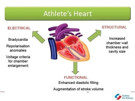 Athlete's Heart