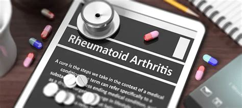 What to Expect When Switching to Biologic Drugs for RA Treatment ...