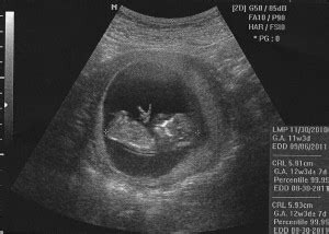 Baby Ultrasound Funny Quotes. QuotesGram