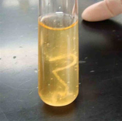 Comparison of Liquid and Solid Bacterial Growth Media