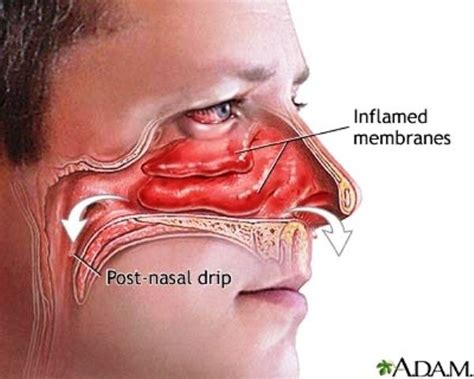 "Clear a stuffed nose or relieve sinus pressure by pushing your tongue ...