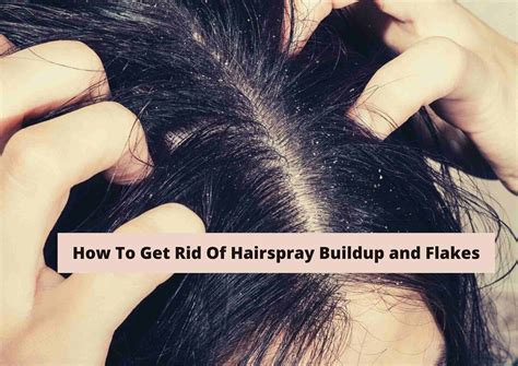 How To Get Rid Of Hairspray Flakes: 5 Great Remedies For Buildup - Hair ...