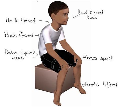 Joint hypermobility in children: what is it and how does it affect posture, coordination and ...