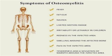 Symptoms of Osteomyelitis - PT Master Guide