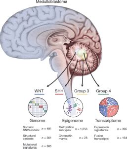 Latest Updates on Medulloblastoma - Dr Prem Pillay