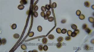 Fungal Spores Under Microscope