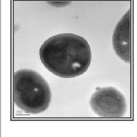 Transmission electron microscopy of Staphylococcus capitis strain... | Download Scientific Diagram