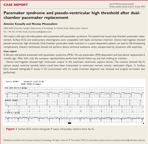 Figure 1 from Pacemaker syndrome and pseudo-ventricular high threshold ...