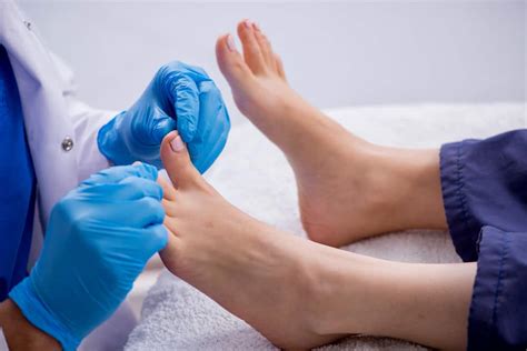 Toenail Fungus Treatment and Prevention Measures - visionsmash