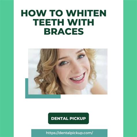 How To Whiten Teeth With Braces? Quick Guide - Dental Pickup