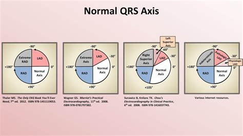 Intro to EKG Interpretation - Rate and Axis - YouTube