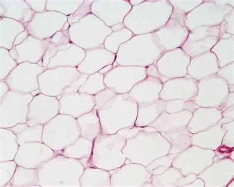 Adipose tissue and its types | Medicine 2024